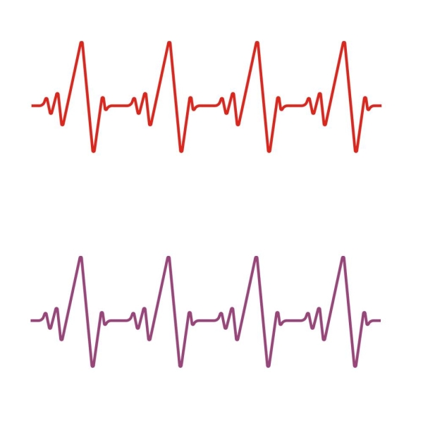 Autoaufkleber Herzschlag Heartbeat Herz Heart Auto Aufkleber A232